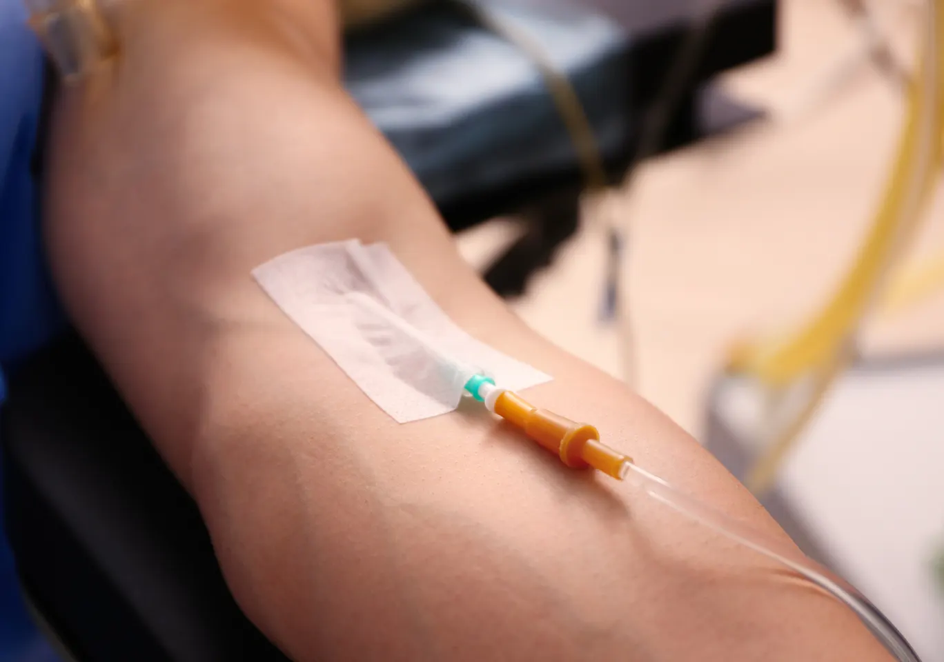 Kroplówki witaminowe Łódź: przedramię z kaniulą i przezroczystym opatrunkiem